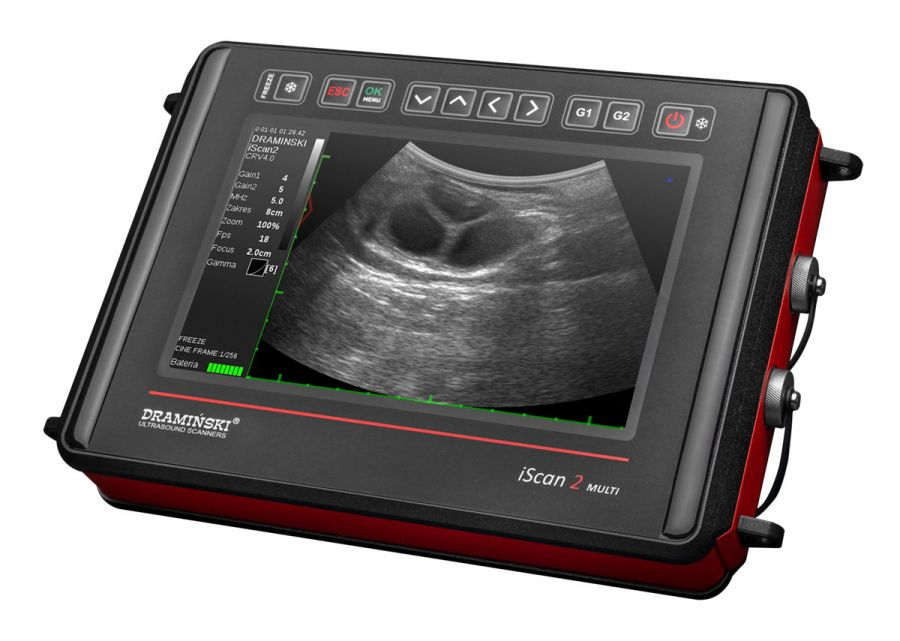 iScan 2 Multi Front iScan 2 Multi Front