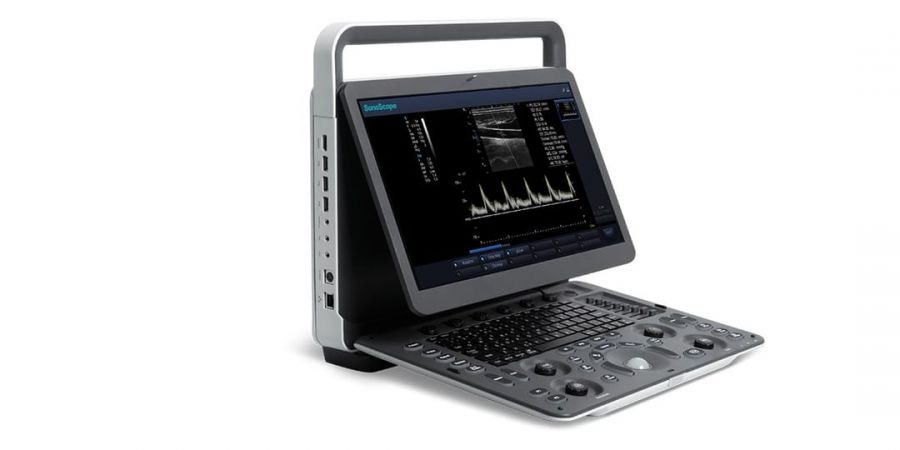 Sonoscape E1 tragbares Ultraschallsystem
