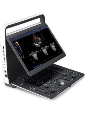 Sonoscape E2 tragbares Ultraschallsystem
